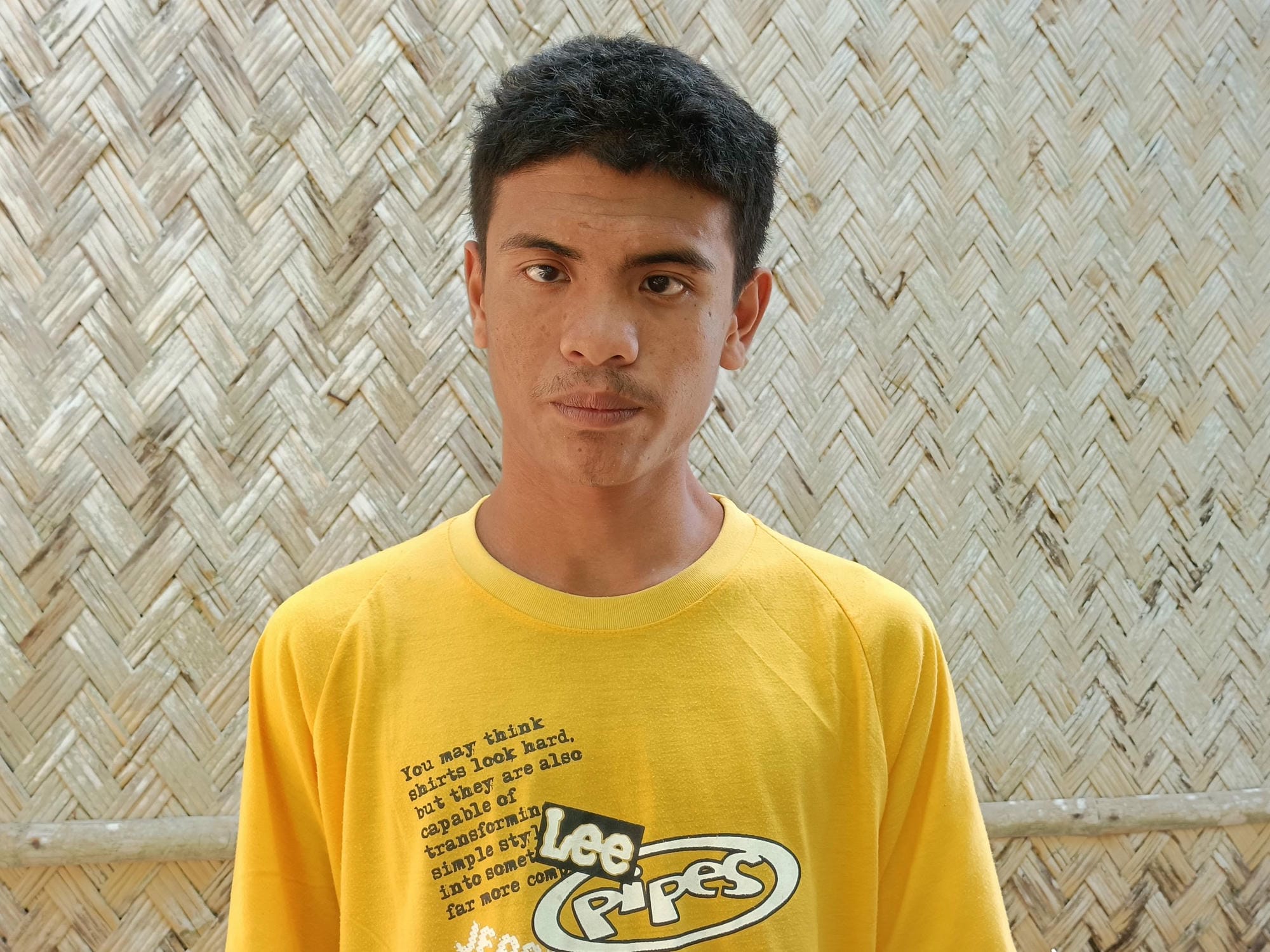 This image has an empty alt attribute; its file name is Benjie_SMC-SS-with-cataract-scaled.jpg