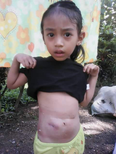 cyrene_post_surgery_photo