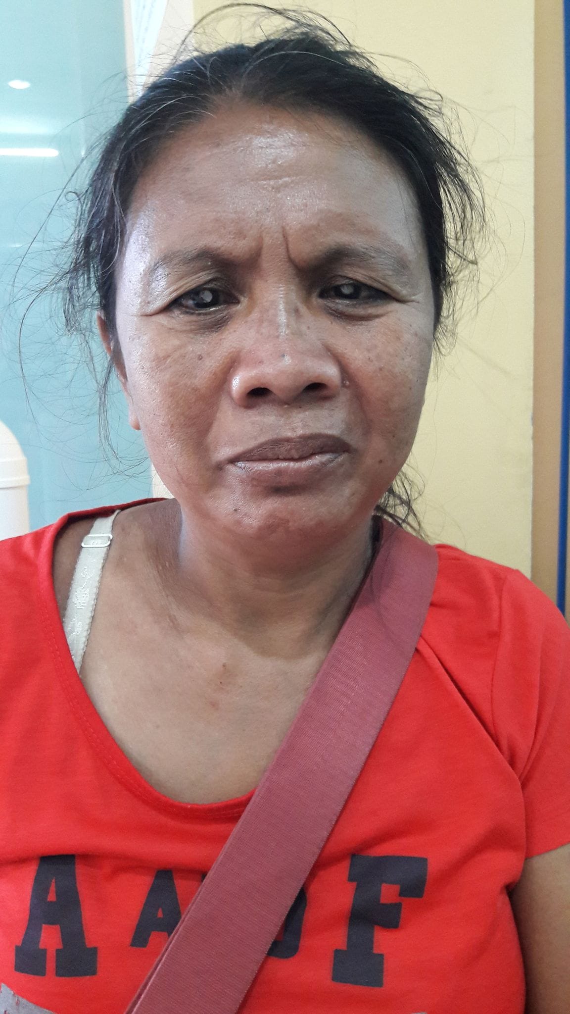 This image has an empty alt attribute; its file name is Gloria_Before-Photo.jpg