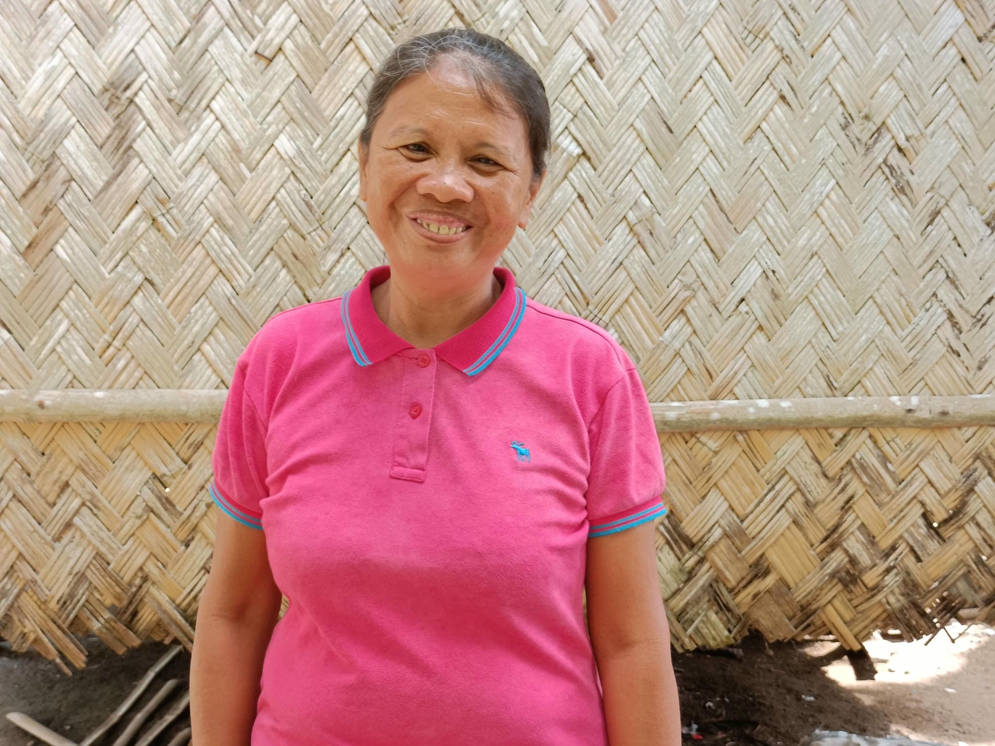 This image has an empty alt attribute; its file name is Gloria_SMC-SS-with-cataract-scaled.jpg