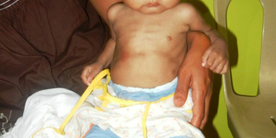 MCO1SMaribaoGEN092212-1-1-scaled-1