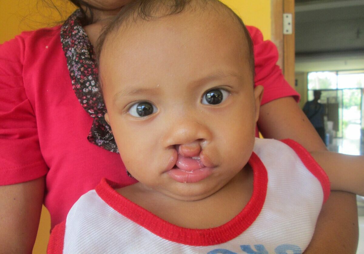 ivan-pre-surgery-1-scaled-2