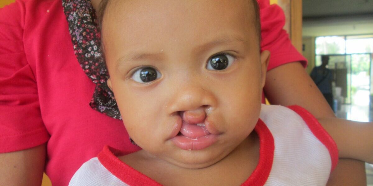 ivan-pre-surgery-1-scaled-2